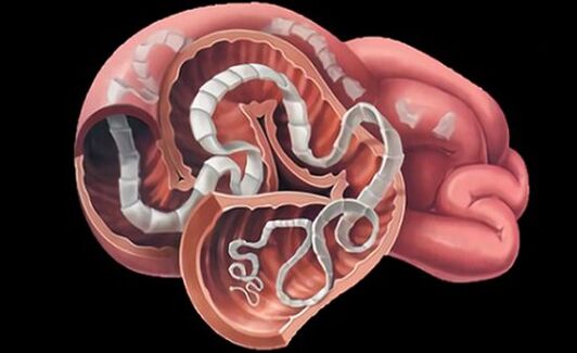 Parassiti nell'intestino